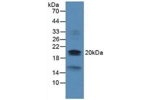 Dual Specificity Phosphatase 3 (DUSP3) (AA 2-185) 抗体