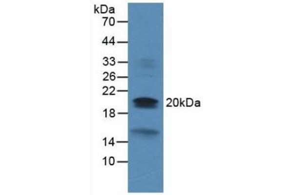 Dual Specificity Phosphatase 3 (DUSP3) (AA 2-185) 抗体