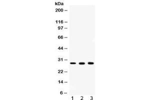 Image no. 4 for anti-Carbonic Anhydrase II (CA2) antibody (ABIN5647703)