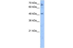 Image no. 1 for anti-Membrane Bound O-Acyltransferase Domain Containing 7 (MBOAT7) antibody (ABIN2463293)