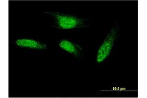 Image no. 1 for anti-SEC14-Like 2 (SEC14L2) (AA 101-199) antibody (ABIN525235)