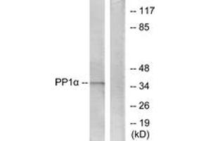 Image no. 2 for anti-Protein Phosphatase 1, Catalytic Subunit, alpha Isoform (PPP1CA) (AA 281-330) antibody (ABIN1532484)