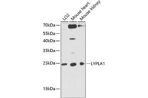 Western blot analysis of extracts of various cell lines, using LYPL antibody (ABIN1680728, ABIN3018907, ABIN3018908 and ABIN6220622) at 1:3000 dilution.