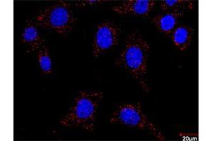 Proximity Ligation Assay (PLA) image for FLT1 & CRKL Protein Protein Interaction Antibody Pair (ABIN1340156)