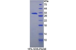 Image no. 1 for Methyltransferase Like 21C (METTL21C) (AA 1-248) protein (T7 tag,His tag) (ABIN6238315)