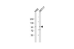 ZMIZ1 anticorps  (C-Term)
