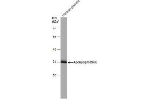 Image no. 3 for anti-Apolipoprotein E (APOE) (N-Term) antibody (ABIN2855049)