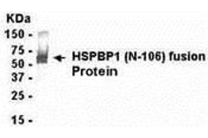 Image no. 1 for anti-HSPA Binding Protein, Cytoplasmic Cochaperone 1 (HSPBP1) (AA 31-136) antibody (ABIN2468045)