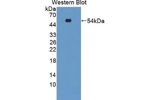 Image no. 1 for anti-erythrocyte Membrane Protein Band 4.2 (EPB42) (AA 475-686) antibody (ABIN1867760)
