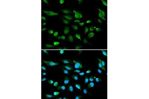 Image no. 4 for anti-Autoimmune Regulator (AIRE) antibody (ABIN3022515)
