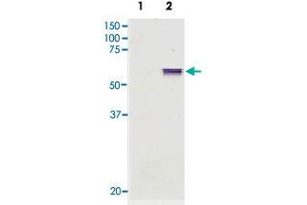 anti-Leucine-Rich Repeat LGI Family, Member 4 (LGI4) antibody