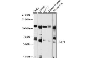 Western blot analysis of extracts of various cell lines, using NET1 antibody (ABIN3021741, ABIN3021742, ABIN1513253 and ABIN6215710) at 1:1000 dilution.