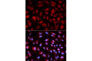 Image no. 2 for anti-Polo-Like Kinase 1 (PLK1) antibody (ABIN3023352)