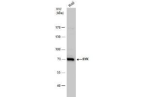 WB Image SYK antibody detects SYK protein by western blot analysis.