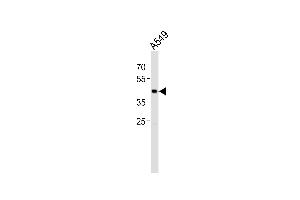 Image no. 1 for anti-TGFB-Induced Factor Homeobox 1 (TGIF1) (AA 81-109), (N-Term) antibody (ABIN5534745)