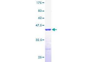 Image no. 1 for Ribosomal Protein, Large, P2 (RPLP2) (AA 1-115) protein (GST tag) (ABIN1318686)