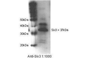Image no. 3 for anti-Sine Oculis-Related Homeobox 3 (SIX3) (Internal Region) antibody (ABIN6657910)