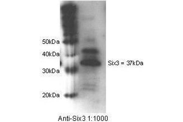 SIX3 antibody  (Internal Region)