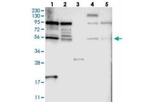 Image no. 1 for anti-TOX High Mobility Group Box Family Member 4 (TOX4) antibody (ABIN5589955)