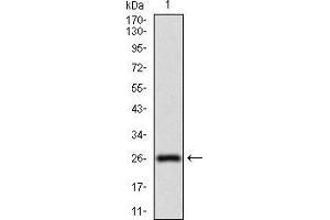 Image no. 4 for anti-5'-Nucleotidase, Ecto (CD73) (NT5E) (AA 30-250) antibody (ABIN2683003)
