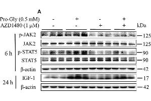 Image no. 2 for anti-Janus Kinase 2 (JAK2) (pTyr1007), (pTyr1008) antibody (ABIN740955)