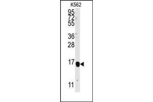 Image no. 1 for anti-Arachidonate 5-Lipoxygenase-Activating Protein (ALOX5AP) (AA 94-124) antibody (ABIN360268)