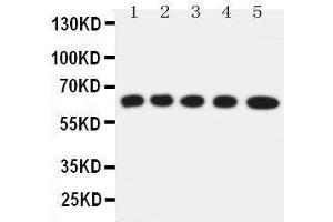 Image no. 1 for anti-Solute Carrier Family 22 Member 5 (SLC22A5) (AA 531-547), (C-Term) antibody (ABIN3042852)