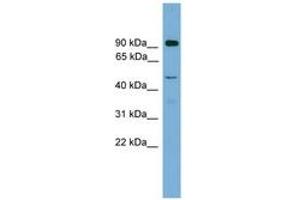 Image no. 1 for anti-Zinc Finger Protein 2, Y Linked (ZFY2) (AA 251-300) antibody (ABIN6744556)