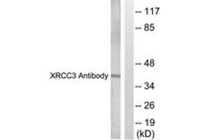 Image no. 2 for anti-X-Ray Repair Complementing Defective Repair in Chinese Hamster Cells 3 (XRCC3) (AA 41-90) antibody (ABIN2889294)