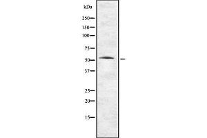 Image no. 1 for anti-Transmembrane Protease, serine 2 (TMPRSS2) (Internal Region) antibody (ABIN6265619)