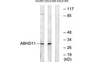 Image no. 1 for anti-Abhydrolase Domain Containing 11 (ABHD11) (AA 161-210) antibody (ABIN1534579)