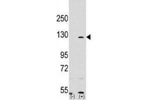 Image no. 1 for anti-Poly (ADP-Ribose) Polymerase 1 (PARP1) (AA 183-214) antibody (ABIN3032164)