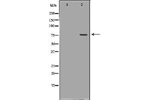 Image no. 1 for anti-Glycyl-tRNA Synthetase (GARS) (C-Term) antibody (ABIN6261883)