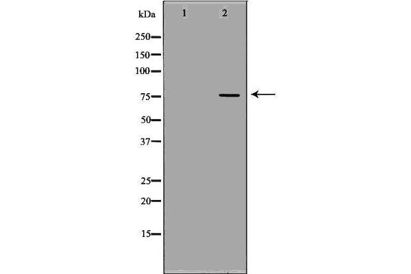 anti-Glycyl-tRNA Synthetase (GARS) (C-Term) antibody