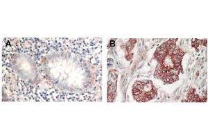 Image no. 2 for anti-V-Akt Murine Thymoma Viral Oncogene Homolog 1 (AKT1) (C-Term) antibody (ABIN94783)