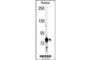 Image no. 1 for anti-Glycyl-tRNA Synthetase (GARS) (AA 706-739), (C-Term) antibody (ABIN392465)