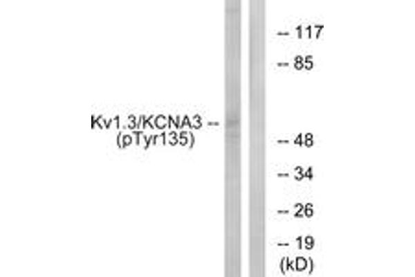 KCNA3 antibody  (pTyr135)