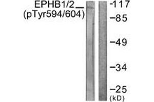 Western blot analysis of extracts from HepG2 cells, using EPHB1/2 (Phospho-Tyr594/604) Antibody.