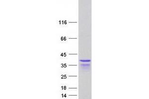 Image no. 1 for Periphilin 1 (PPHLN1) (Transcript Variant 8) protein (Myc-DYKDDDDK Tag) (ABIN2728687)