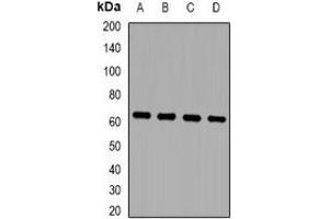 Image no. 2 for anti-Zinc Finger Protein 307 (ZKSCAN4) antibody (ABIN3223027)