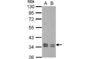 Image no. 4 for anti-Rab Geranylgeranyltransferase, beta Subunit (RABGGTB) (Center) antibody (ABIN2856206)