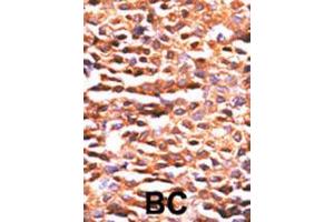 Image no. 1 for anti-Protein Phosphatase 2, Catalytic Subunit, alpha Isozyme (PPP2CA) (AA 1-30), (N-Term) antibody (ABIN392889)