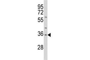 Image no. 5 for anti-Interleukin 1 alpha (IL1A) (AA 177-206) antibody (ABIN3031433)