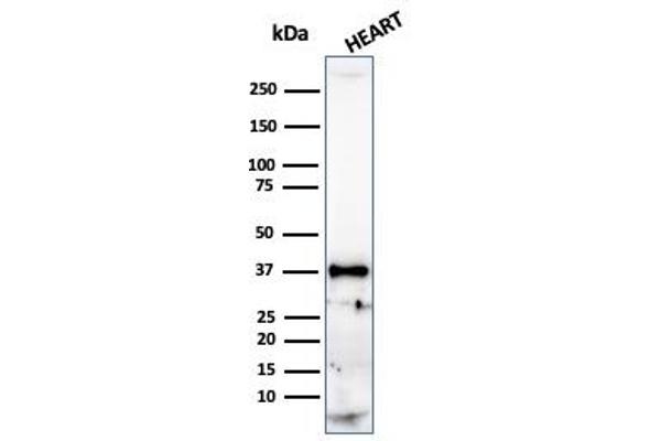 Recombinant Histone H1 anticorps