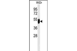 SETD6 antibody  (C-Term)