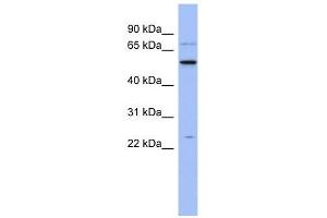 Image no. 1 for anti-Zinc Finger CCHC-Type and RNA Binding Motif 1 (ZCRB1) (N-Term) antibody (ABIN633544)