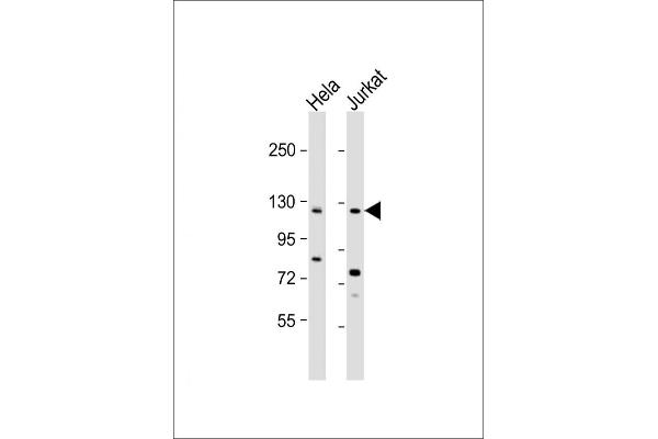 SRGAP3 抗体  (C-Term)
