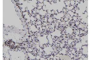 Image no. 2 for anti-Jun B Proto-Oncogene (JUNB) (pThr255) antibody (ABIN6269895)