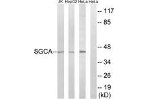 Image no. 1 for anti-Sarcoglycan, alpha (50kDa Dystrophin-Associated Glycoprotein) (SGCA) (AA 161-210) antibody (ABIN1534624)