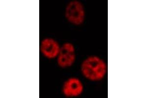 Image no. 1 for anti-Nuclear Factor-kB p65 (NFkBP65) antibody (ABIN6263616)